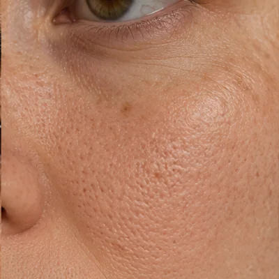Clearer-looking skin