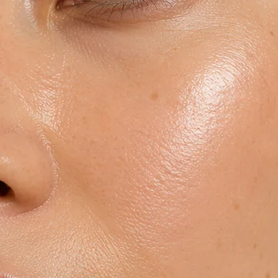 Anti-ageing care