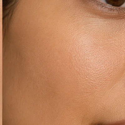 All skin types